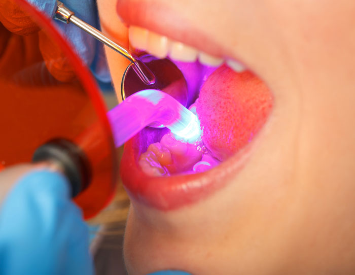 A dentist doing laser treatments