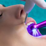 Dental Laser Therapy in Riverview FL Area