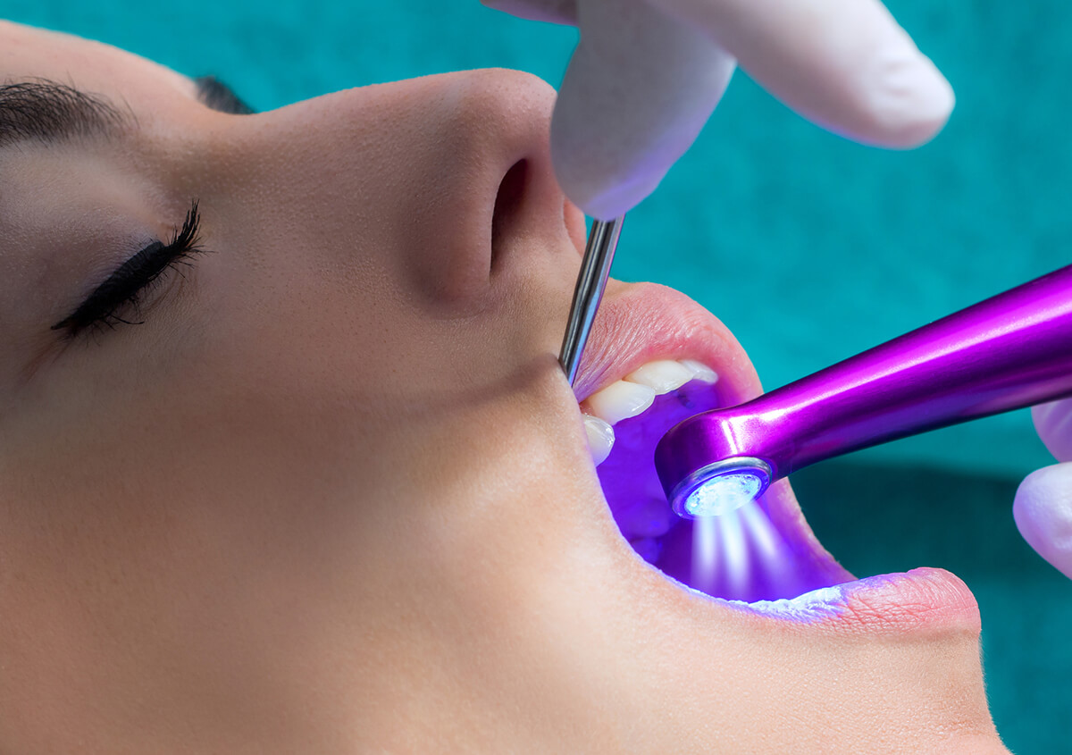 Discover the benefits of dental laser therapy in Riverview, FL